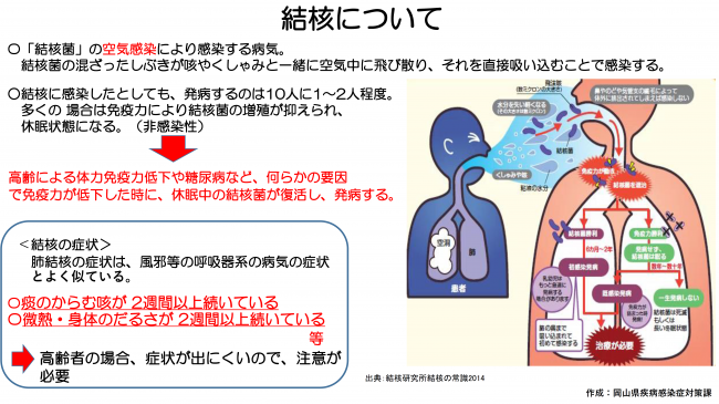 結核について