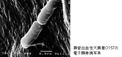 腸管出血性大腸菌O157の電子顕微鏡写真