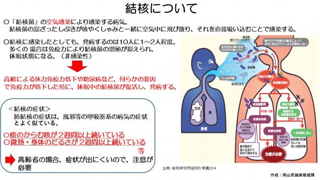 結核について